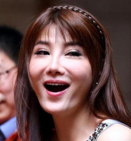 明星整容鼻子歪了,鼻子歪斜引发热议